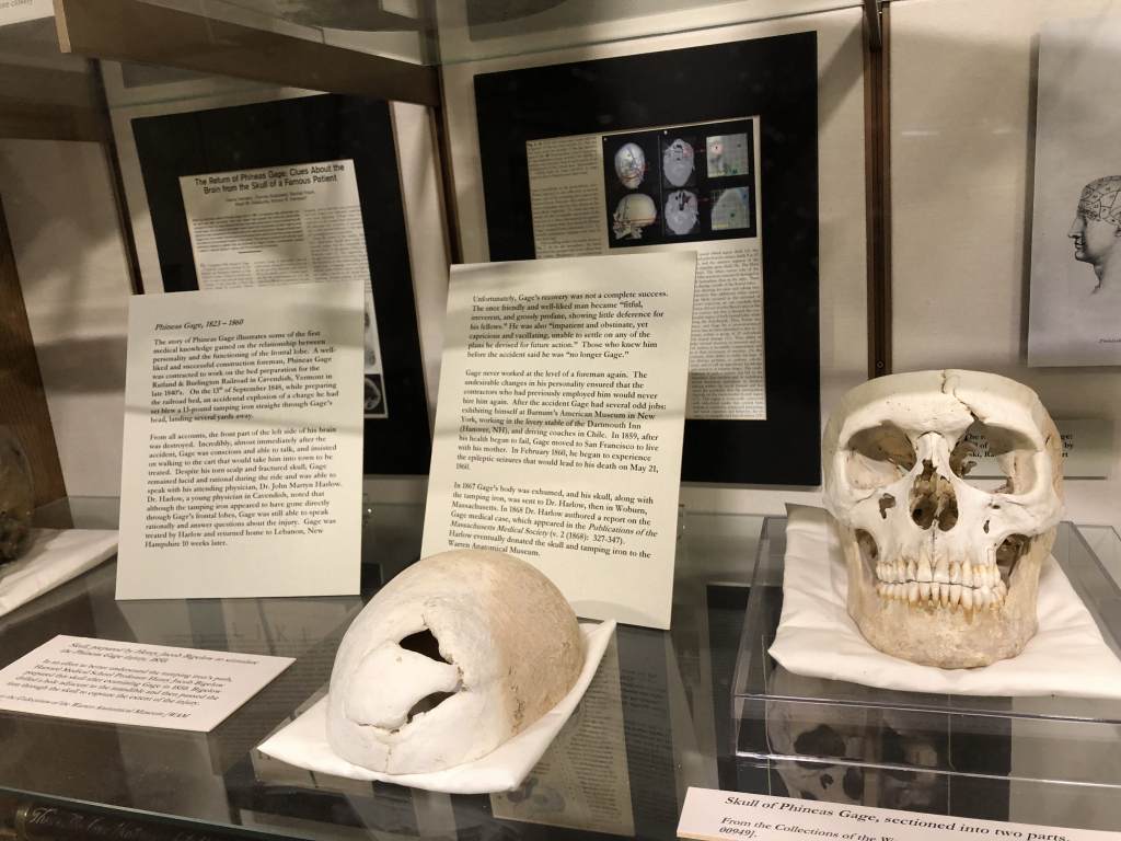 The Strange Case of Phineas Gage